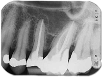 Porte-films Super-Bite - Kerr