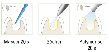 CMF Adhesive System - SAREMCO