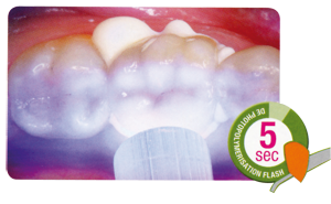 Ketac Cem Plus Automix - 3M ESPE