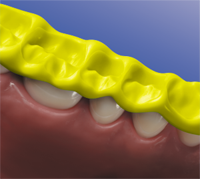 Greenbite Colour - Detax
